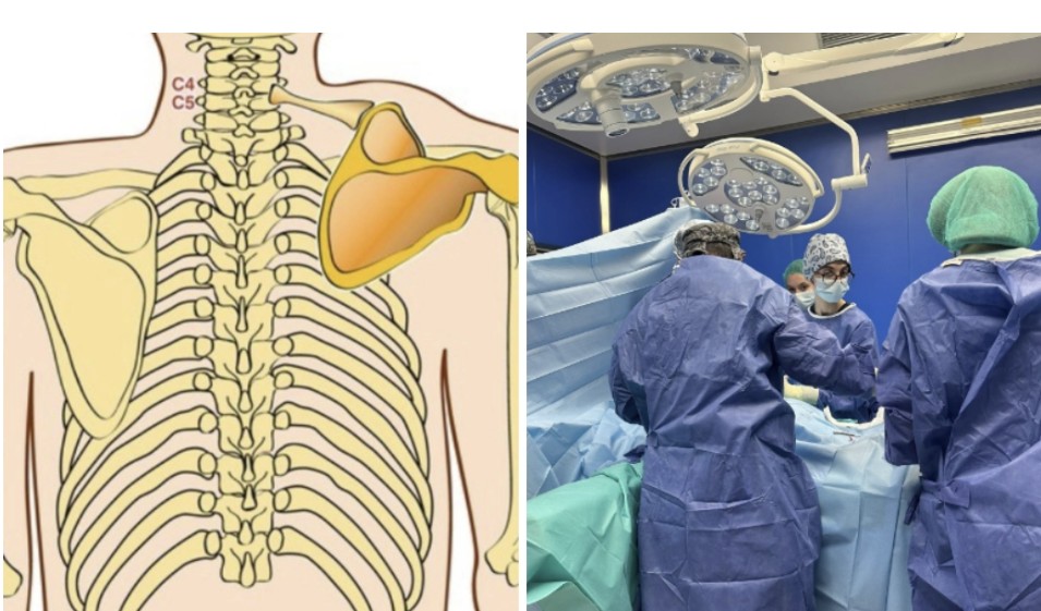 ИСТОРИСКИ ЗАФАТ НА ТОАРИЛУЦ Комплексна операција кај 4-годишно дете ИСТОРИСКИ ЗАФАТ НА ТОАРИЛУЦ Комплексна операција кај 4-годишно дете